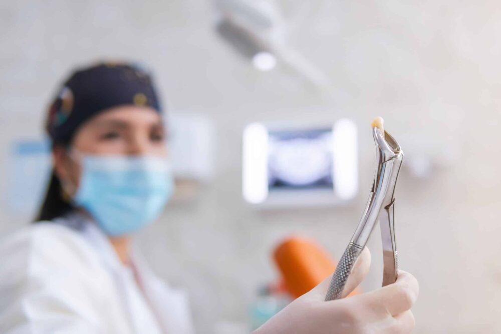 Tooth Extractions North Ogden