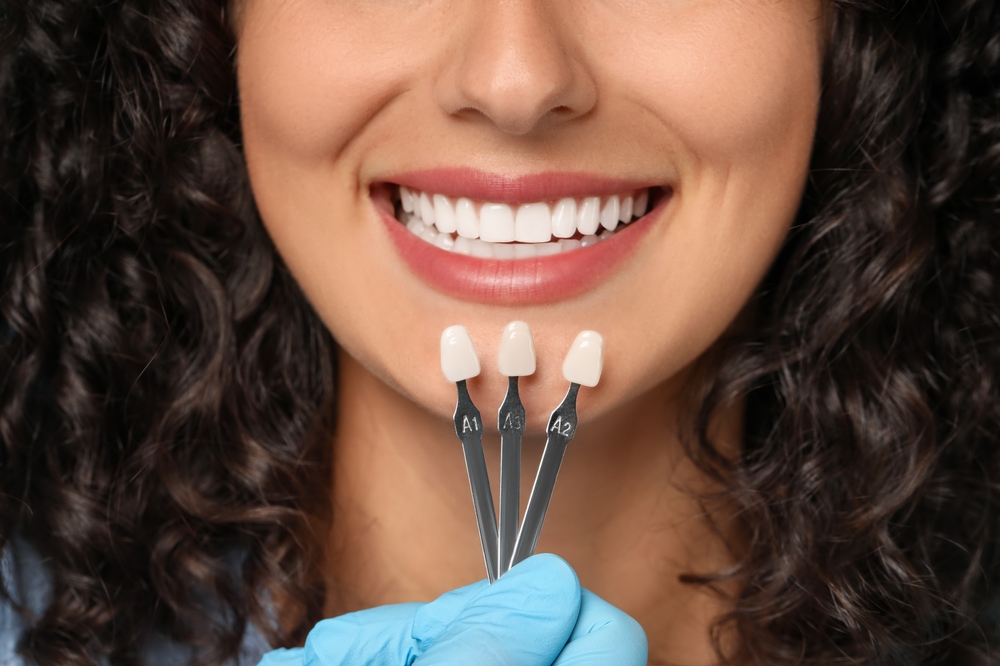 Dental Veneers North Ogden